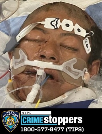 NYPD trying to identify man critically injured in bicycle crash